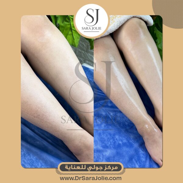 WhatsApp Image 2025 07 01 at 1 25 21 PM 1 600x600