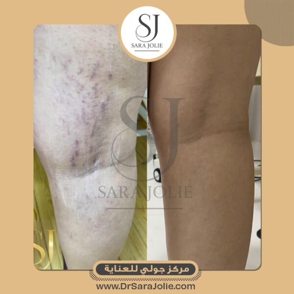 WhatsApp Image 2025 07 01 at 1 25 21 PM 2 600x600