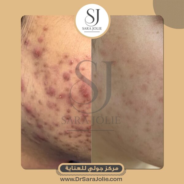 WhatsApp Image 2025 07 01 at 1 25 21 PM 3 600x600