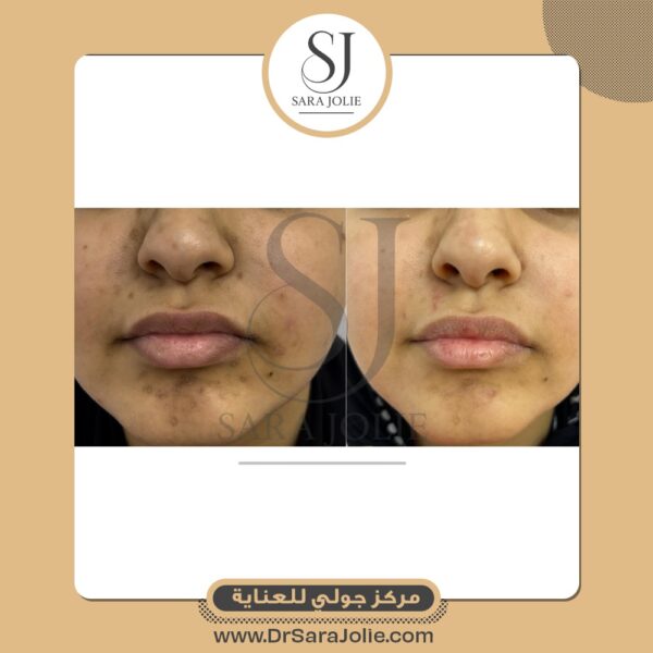 WhatsApp Image 2025 07 01 at 1 25 22 PM 1 600x600