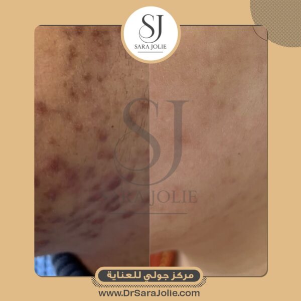 WhatsApp Image 2025 07 01 at 1 25 22 PM 600x600