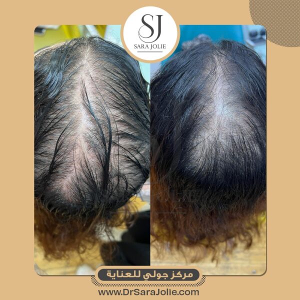 WhatsApp Image 2025 07 01 at 1 25 23 PM 600x600