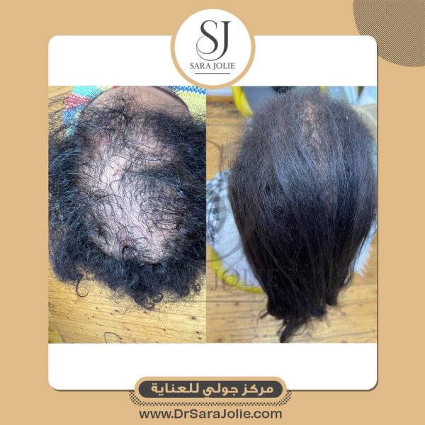 WhatsApp Image 2025 07 01 at 1 25 24 PM 1 600x600