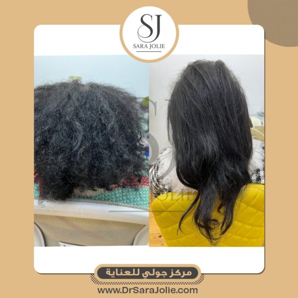 WhatsApp Image 2025 07 01 at 1 25 24 PM 600x600